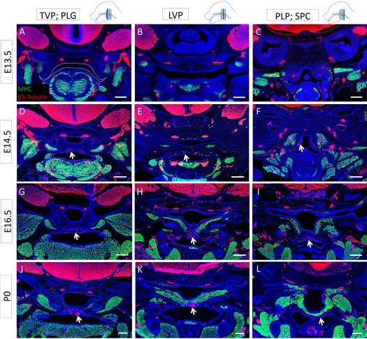 Immunohistochemistry (Formalin/PFA-fixed paraffin-embedded sections) - Anti-beta III Tubulin antibody [2G10] - Neuronal Marker (AB78078), expandable thumbnail