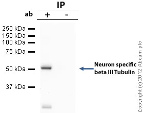 Immunoprecipitation - Anti-beta III Tubulin antibody [2G10] - Neuronal Marker (AB78078)