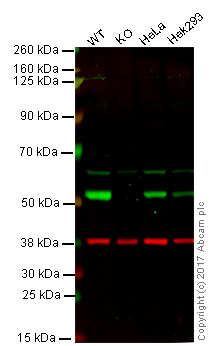 Western blot - Anti-beta III Tubulin antibody [2G10] - Neuronal Marker (ab78078), expandable thumbnail