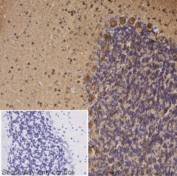 Immunohistochemistry (Formalin/PFA-fixed paraffin-embedded sections) - Anti-beta III Tubulin antibody [5G8] - Neuronal Marker (AB231084)