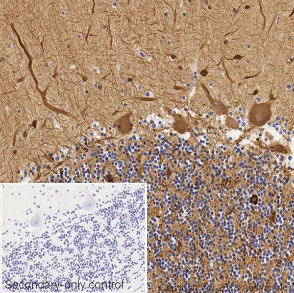 Immunohistochemistry (Formalin/PFA-fixed paraffin-embedded sections) - Anti-beta III Tubulin antibody [5G8] (AB231084), expandable thumbnail