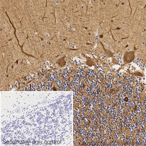 Immunohistochemistry (Formalin/PFA-fixed paraffin-embedded sections) - Anti-beta III Tubulin antibody [5G8] - Neuronal Marker (AB231084)