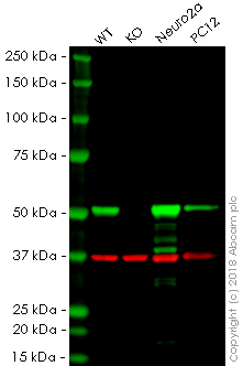 Western blot - Anti-beta III Tubulin antibody [5G8] - Neuronal Marker (AB231084), expandable thumbnail