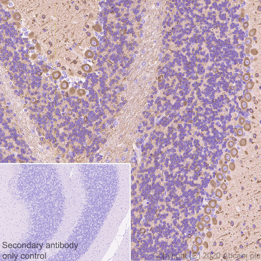 Immunohistochemistry (Formalin/PFA-fixed paraffin-embedded sections) - Anti-beta III Tubulin antibody [AA10] - Neuronal Marker (AB231083), expandable thumbnail