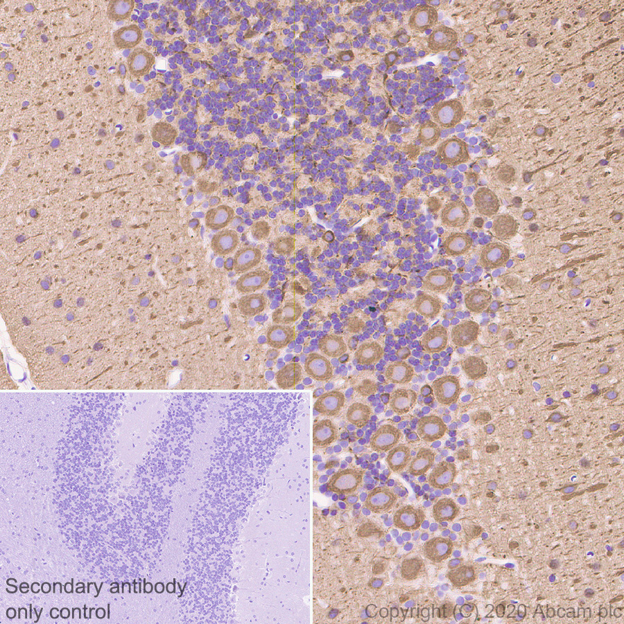 Immunohistochemistry (Formalin/PFA-fixed paraffin-embedded sections) - Anti-beta III Tubulin antibody [AA10] - Neuronal Marker (AB231083), expandable thumbnail