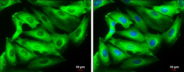 Immunocytochemistry/ Immunofluorescence - Anti-beta III Tubulin antibody - C-terminal (AB230847), expandable thumbnail