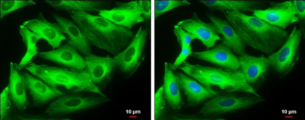Immunocytochemistry/ Immunofluorescence - Anti-beta III Tubulin antibody - C-terminal - Neuronal Marker (AB230847)