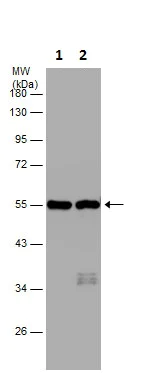 Western blot - Anti-beta III Tubulin antibody - C-terminal - Neuronal Marker (AB230847)