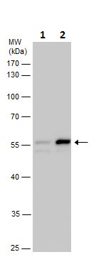 Western blot - Anti-beta III Tubulin antibody - C-terminal - Neuronal Marker (AB230847), expandable thumbnail