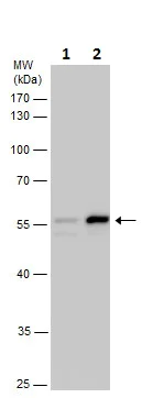 Western blot - Anti-beta III Tubulin antibody - C-terminal - Neuronal Marker (AB230847)