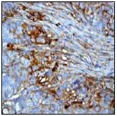 Immunohistochemistry (Formalin/PFA-fixed paraffin-embedded sections) - Anti-beta III Tubulin antibody [EP1569Y] - BSA and Azide free (AB221935)