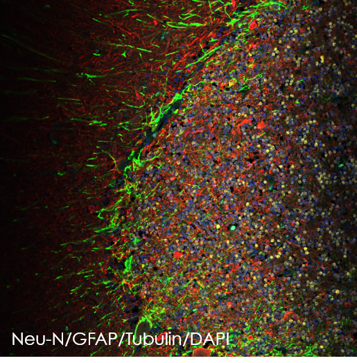 Multiplex immunohistochemistry - Anti-beta III Tubulin antibody [EP1569Y] - BSA and Azide free (AB221935)