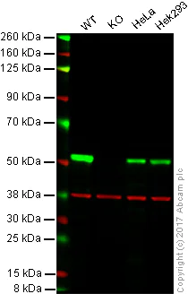 Western blot - Anti-beta III Tubulin antibody [EP1569Y] - BSA and Azide free (AB221935)