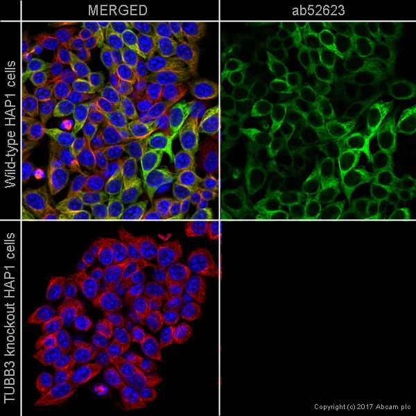Immunocytochemistry/ Immunofluorescence - Anti-beta III Tubulin antibody [EP1569Y] - Neuronal Marker (AB52623)