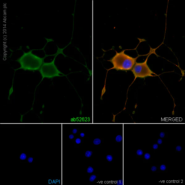 Immunocytochemistry/ Immunofluorescence - Anti-beta III Tubulin antibody [EP1569Y] - Neuronal Marker (AB52623)