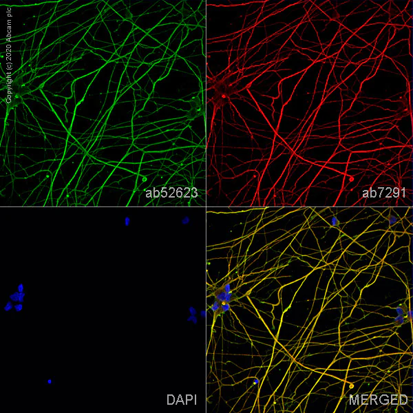 Immunocytochemistry/ Immunofluorescence - Anti-beta III Tubulin antibody [EP1569Y] - Neuronal Marker (AB52623)