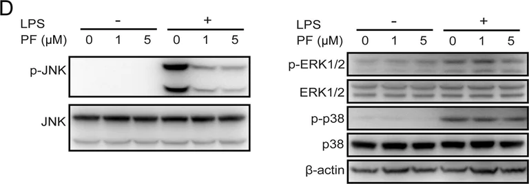 Western blot - Anti-beta III Tubulin antibody [EP1569Y] - Neuronal Marker (AB52623)