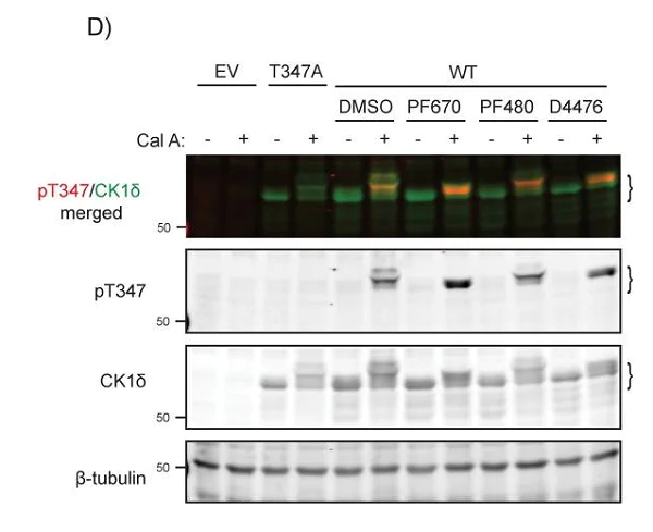 Western blot - Anti-beta III Tubulin antibody [EP1569Y] - Neuronal Marker (AB52623)