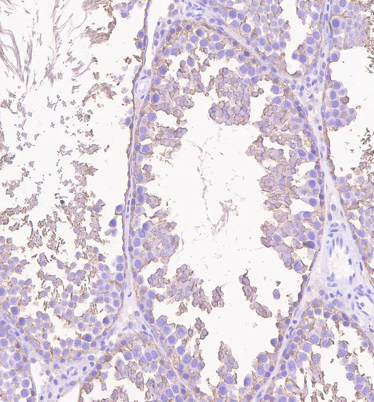 Immunohistochemistry (Formalin/PFA-fixed paraffin-embedded sections) - Anti-beta III Tubulin antibody [EPR1568Y] - BSA and Azide free (AB247375)