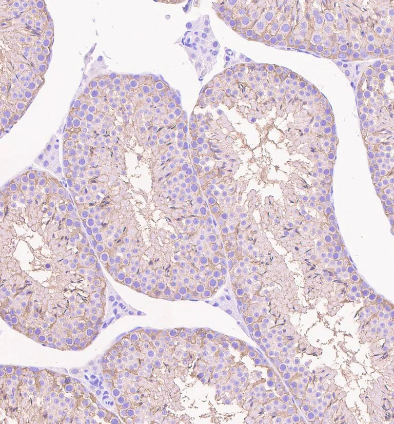 Immunohistochemistry (Formalin/PFA-fixed paraffin-embedded sections) - Anti-beta III Tubulin antibody [EPR1568Y] - BSA and Azide free (AB247375)