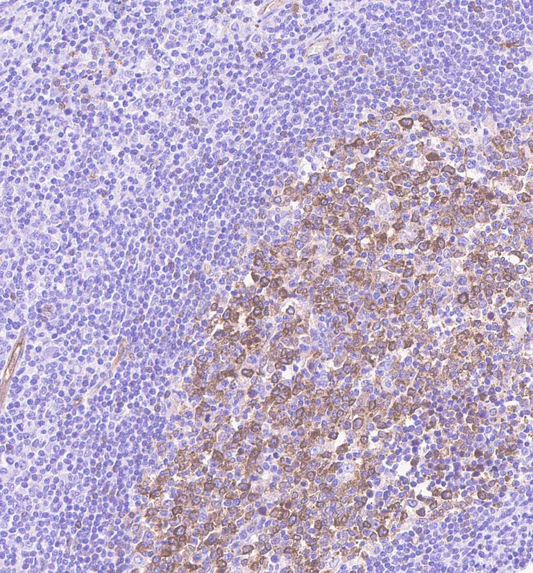 Immunohistochemistry (Formalin/PFA-fixed paraffin-embedded sections) - Anti-beta III Tubulin antibody [EPR1568Y] - BSA and Azide free (AB247375)