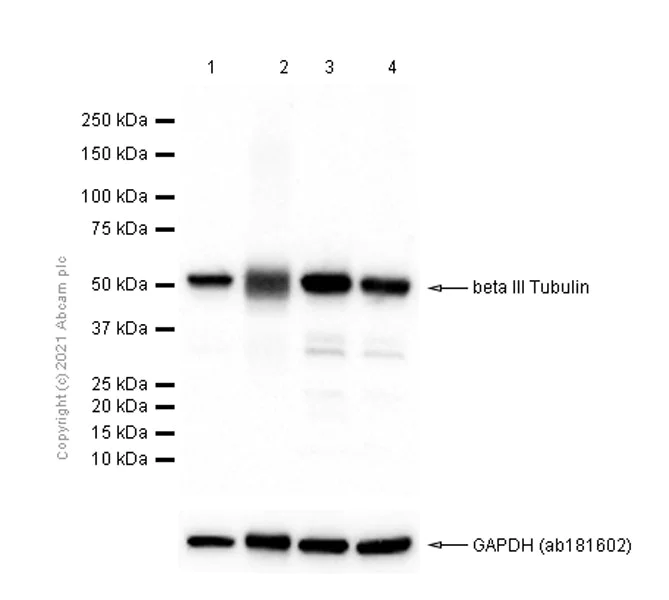 Western blot - Anti-beta III Tubulin antibody [EPR1568Y] - BSA and Azide free (AB247375)