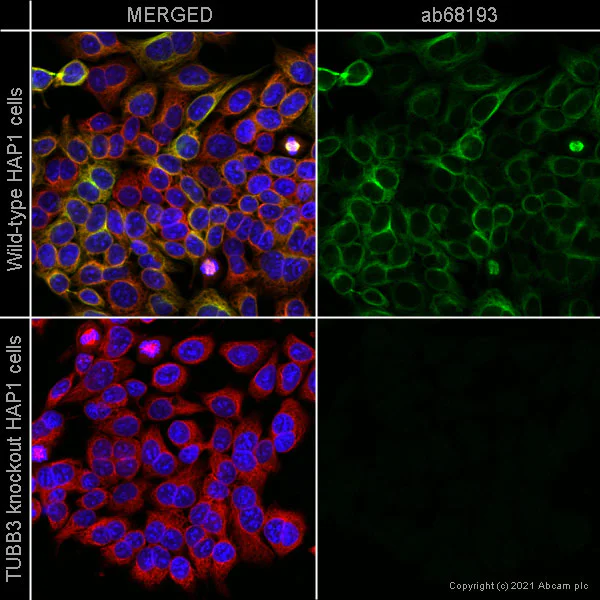Immunocytochemistry/ Immunofluorescence - Anti-beta III Tubulin antibody [EPR1568Y] - Neuronal Marker (AB68193)