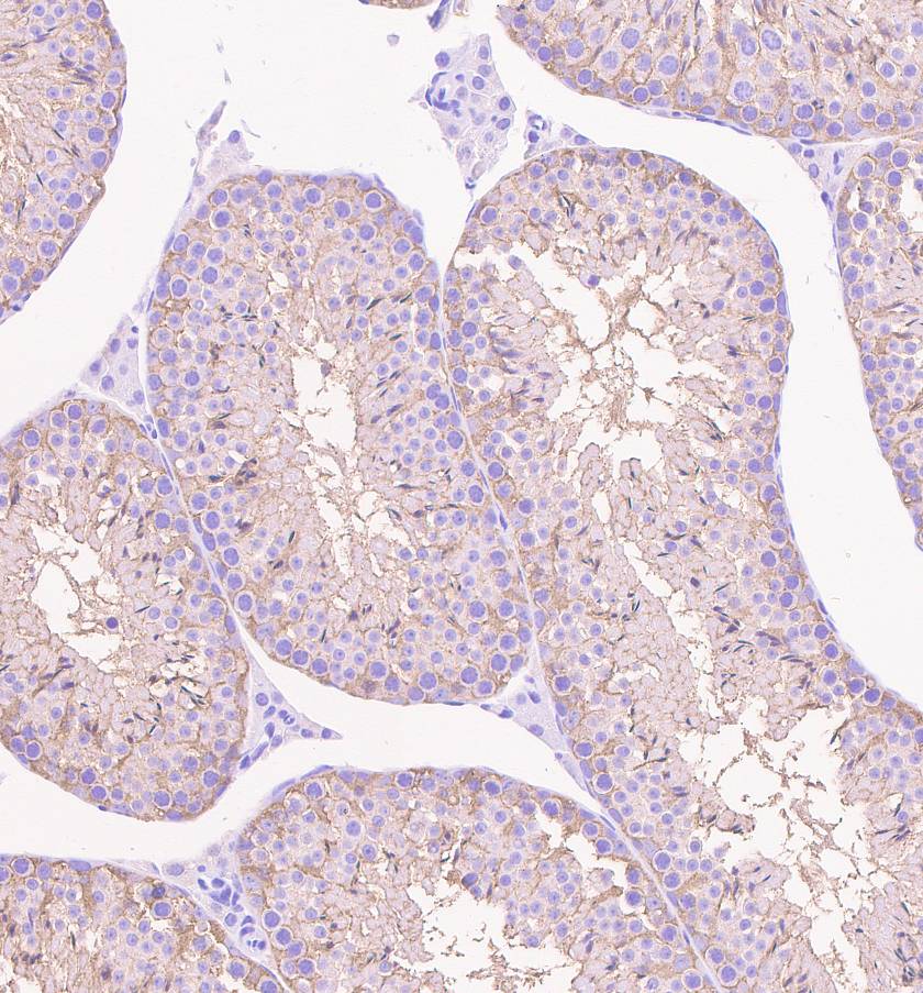 Immunohistochemistry (Formalin/PFA-fixed paraffin-embedded sections) - Anti-beta III Tubulin antibody [EPR1568Y] (ab68193), expandable thumbnail