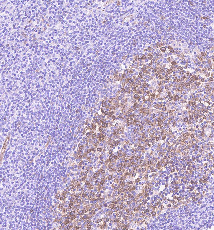 Immunohistochemistry (Formalin/PFA-fixed paraffin-embedded sections) - Anti-beta III Tubulin antibody [EPR1568Y] (ab68193), expandable thumbnail