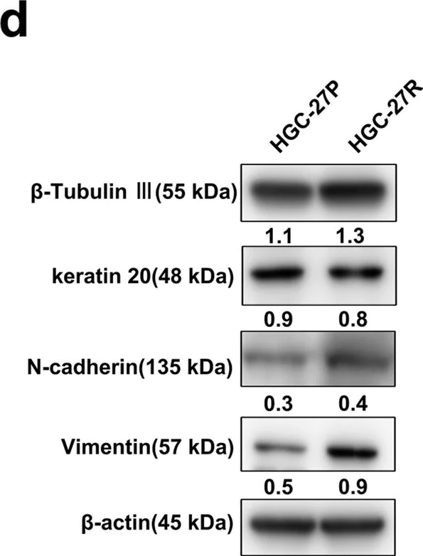 Western blot - Anti-beta III Tubulin antibody [EPR1568Y] - Neuronal Marker (AB68193)