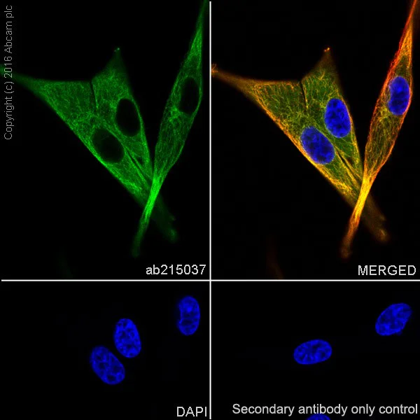 Immunocytochemistry/ Immunofluorescence - Anti-beta III Tubulin antibody [EPR19591] - Neuronal Marker (AB215037)
