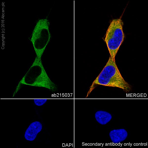 Immunocytochemistry/ Immunofluorescence - Anti-beta III Tubulin antibody [EPR19591] (ab215037), expandable thumbnail