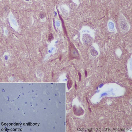 Immunohistochemistry (Formalin/PFA-fixed paraffin-embedded sections) - Anti-beta III Tubulin antibody [EPR19591] (ab215037), expandable thumbnail