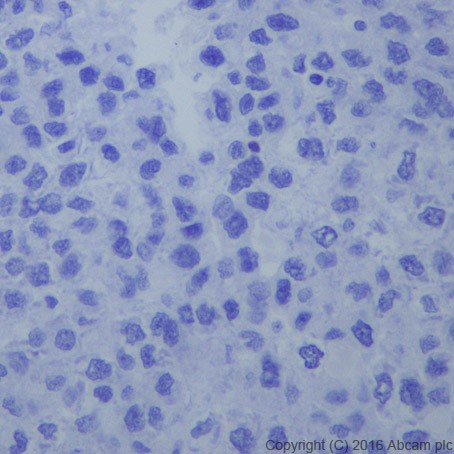 Immunohistochemistry (Formalin/PFA-fixed paraffin-embedded sections) - Anti-beta III Tubulin antibody [EPR19591] (ab215037), expandable thumbnail