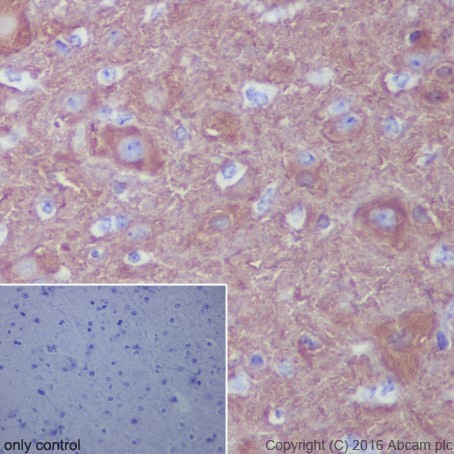 Immunohistochemistry (Formalin/PFA-fixed paraffin-embedded sections) - Anti-beta III Tubulin antibody [EPR19591] (ab215037), expandable thumbnail
