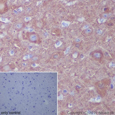 Immunohistochemistry (Formalin/PFA-fixed paraffin-embedded sections) - Anti-beta III Tubulin antibody [EPR19591] - Neuronal Marker (AB215037)