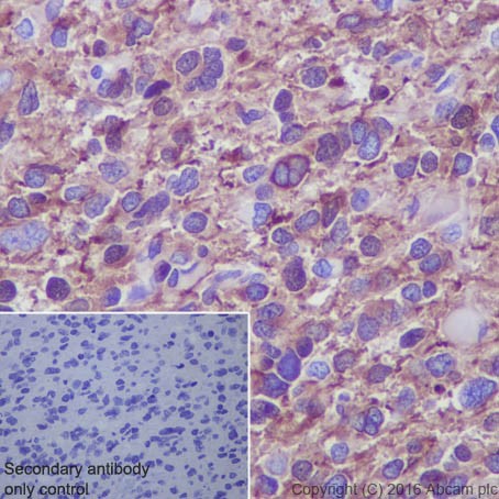 Immunohistochemistry (Formalin/PFA-fixed paraffin-embedded sections) - Anti-beta III Tubulin antibody [EPR19591] (ab215037), expandable thumbnail
