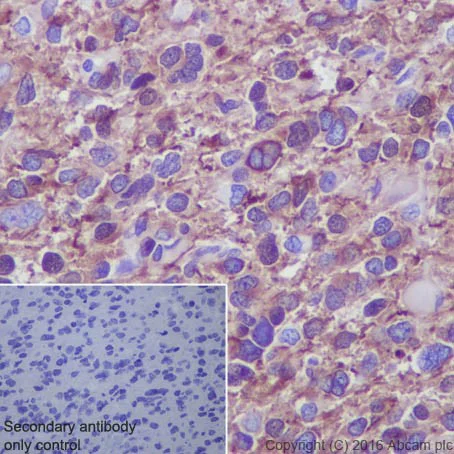 Immunohistochemistry (Formalin/PFA-fixed paraffin-embedded sections) - Anti-beta III Tubulin antibody [EPR19591] - Neuronal Marker (AB215037)