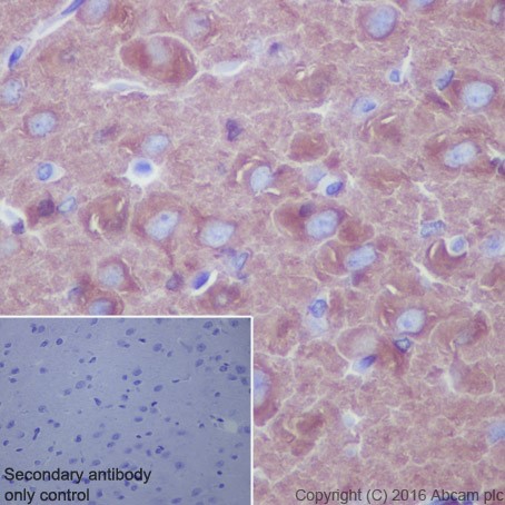 Immunohistochemistry (Formalin/PFA-fixed paraffin-embedded sections) - Anti-beta III Tubulin antibody [EPR19591] (ab215037), expandable thumbnail