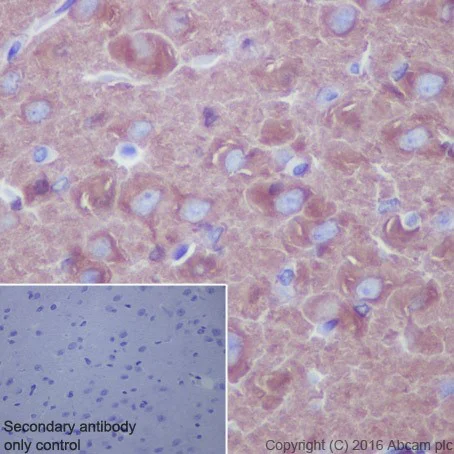 Immunohistochemistry (Formalin/PFA-fixed paraffin-embedded sections) - Anti-beta III Tubulin antibody [EPR19591] - Neuronal Marker (AB215037)