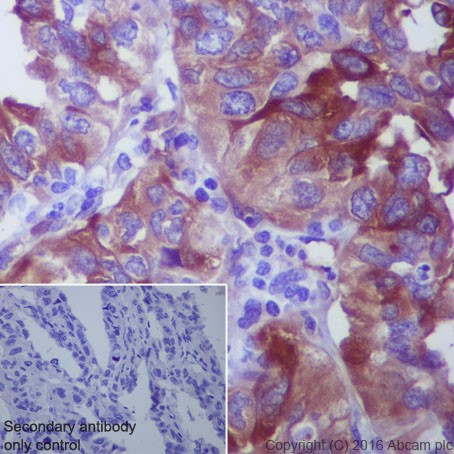 Immunohistochemistry (Formalin/PFA-fixed paraffin-embedded sections) - Anti-beta III Tubulin antibody [EPR19591] (ab215037), expandable thumbnail