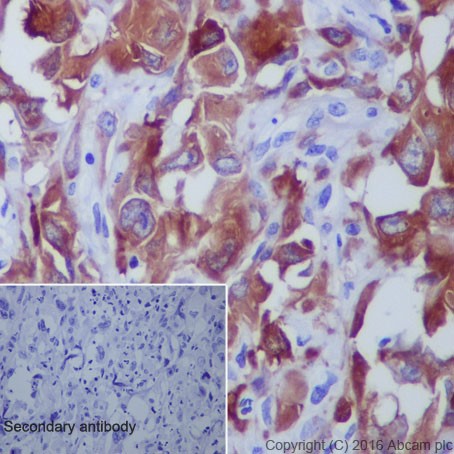 Immunohistochemistry (Formalin/PFA-fixed paraffin-embedded sections) - Anti-beta III Tubulin antibody [EPR19591] (AB215037), expandable thumbnail