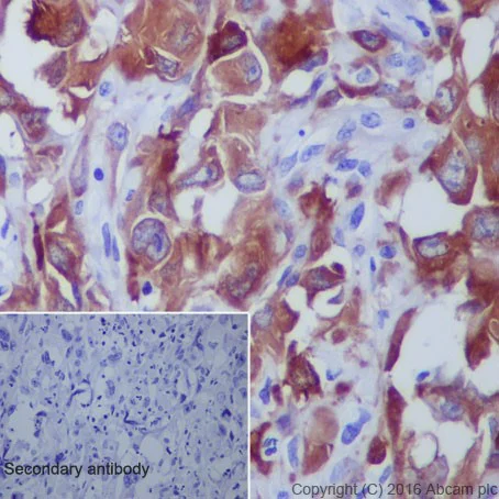 Immunohistochemistry (Formalin/PFA-fixed paraffin-embedded sections) - Anti-beta III Tubulin antibody [EPR19591] - Neuronal Marker (AB215037)