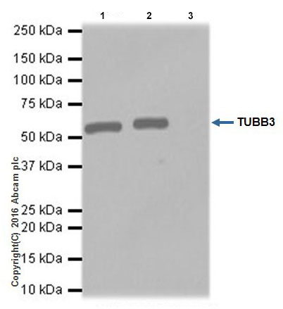 Immunoprecipitation - Anti-beta III Tubulin antibody [EPR19591] - Neuronal Marker (ab215037), expandable thumbnail