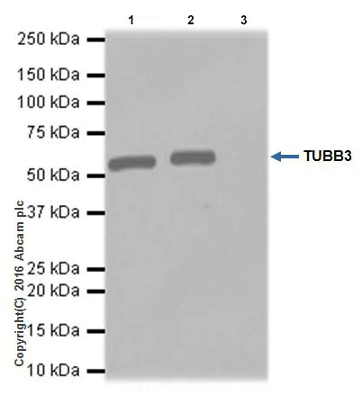Immunoprecipitation - Anti-beta III Tubulin antibody [EPR19591] - Neuronal Marker (AB215037)