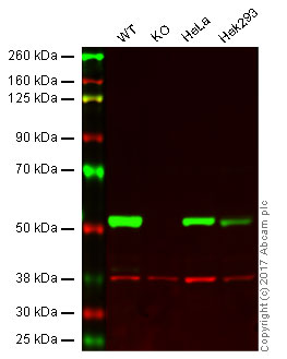 Western blot - Anti-beta III Tubulin antibody [EPR19591] - Neuronal Marker (AB215037), expandable thumbnail