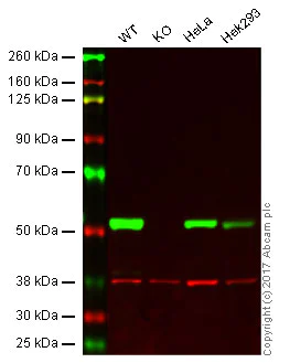 Western blot - Anti-beta III Tubulin antibody [EPR19591] - Neuronal Marker (AB215037)