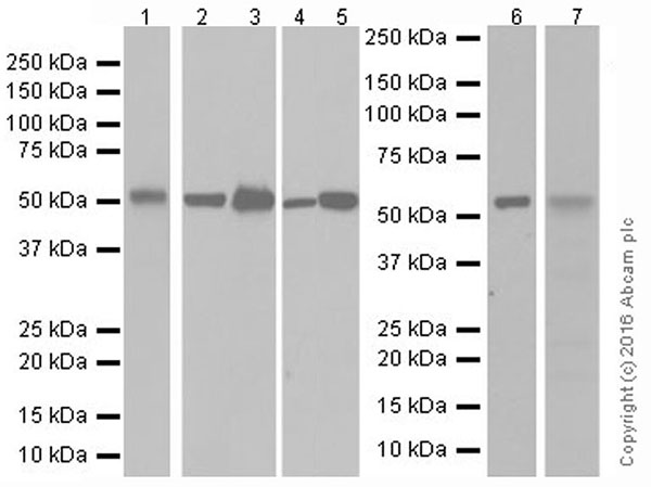 Western blot - Anti-beta III Tubulin antibody [EPR19591] - Neuronal Marker (ab215037), expandable thumbnail