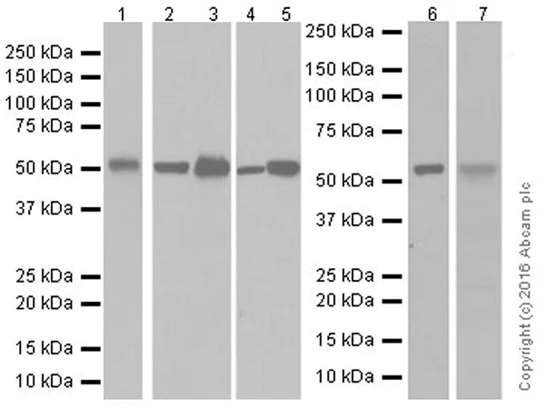 Western blot - Anti-beta III Tubulin antibody [EPR19591] - Neuronal Marker (AB215037)