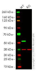 Western blot - Anti-beta III Tubulin antibody [EPR19591] - Neuronal Marker (AB215037), expandable thumbnail
